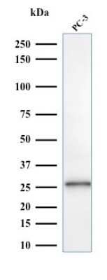 Western Blot: Complement Component C1qA Antibody (C1QA/2953) [NBP2-79782]