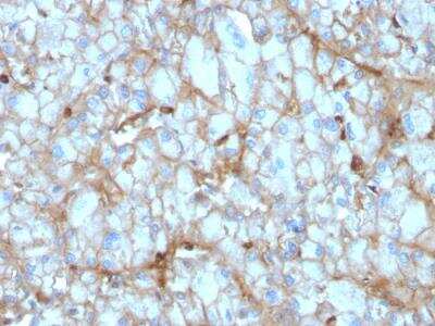 Immunohistochemistry-Paraffin: Complement Component C1qA Antibody (C1QA/2954) - Azide and BSA Free [NBP2-79919]