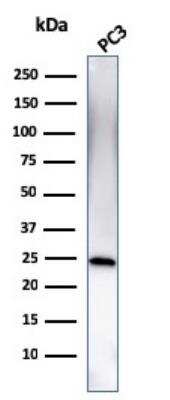 Western Blot: Complement Component C1qA Antibody (C1QA/2954)Azide and BSA Free [NBP2-79919]