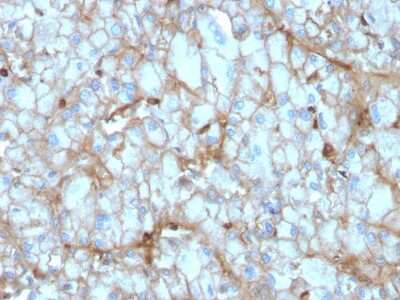 Immunohistochemistry-Paraffin: Complement Component C1qA Antibody (C1QA/2954) [NBP2-79785]
