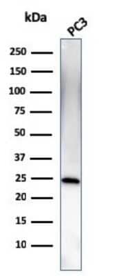 Western Blot: Complement Component C1qA Antibody (C1QA/2954) [NBP2-79785]