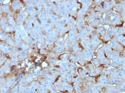 Immunohistochemistry-Paraffin: Complement Component C1qA Antibody (C1QA/2955) [NBP3-07733]
