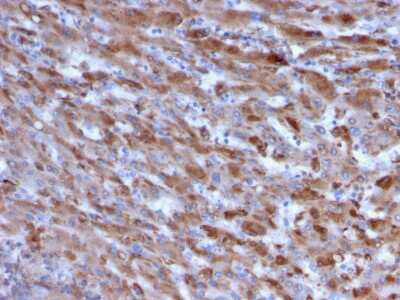 Immunohistochemistry-Paraffin: Complement Component C1qA Antibody (C1QA/2955) - Azide and BSA Free [NBP3-08748]