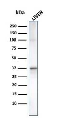 Western Blot: Complement Component C1qA Antibody (C1QA/2955) [NBP3-07733]