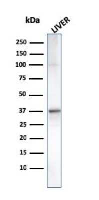 Western Blot: Complement Component C1qA Antibody (C1QA/2955)Azide and BSA Free [NBP3-08748]