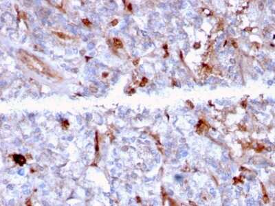 Immunohistochemistry-Paraffin: Complement Component C1qA Antibody (C1QA/2956) - Azide and BSA Free [NBP3-08755]