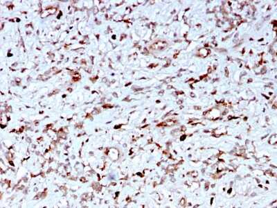Immunohistochemistry-Paraffin: Complement Component C1qA Antibody (C1QA/2956) - Azide and BSA Free [NBP3-08755]