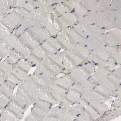 Immunohistochemistry-Paraffin: Complement Component C1qC Antibody [NBP1-89885]