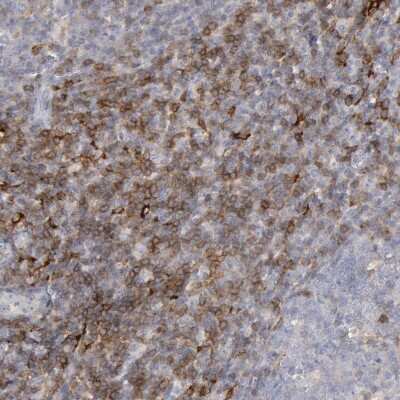 Immunohistochemistry-Paraffin: Complement Component C1qC Antibody [NBP1-89885]