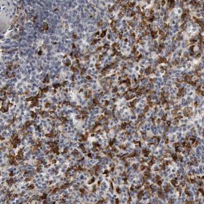 Immunohistochemistry-Paraffin: Complement Component C1qC Antibody [NBP1-89885]