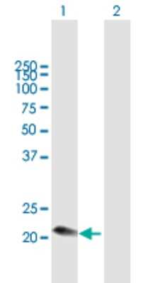 Western Blot: Complement Component C1qC Antibody [H00000714-B01P]