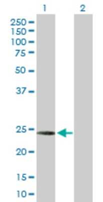 Western Blot: Complement Component C1qC Antibody [H00000714-D01P]