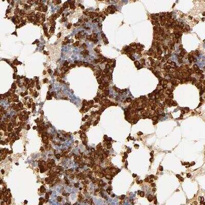 Immunohistochemistry-Paraffin: Complement Component C1r Antibody [NBP1-86527]