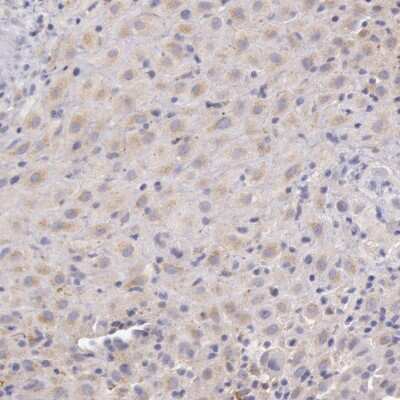 Immunohistochemistry-Paraffin: Complement Component C1r Antibody [NBP2-55545]