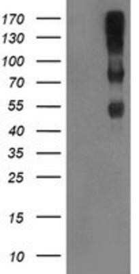 Western Blot: Complement Component C1r Antibody (OTI1F1)Azide and BSA Free [NBP2-70318]