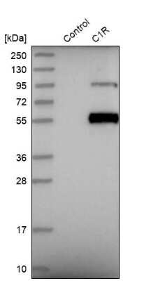 Western Blot: Complement Component C1r Antibody [NBP1-86527]