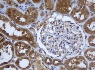 Immunohistochemistry: Complement Component C1s Antibody (OTI2A8) [NBP2-45566]