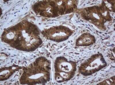 Immunohistochemistry: Complement Component C1s Antibody (OTI2A8) [NBP2-45566]