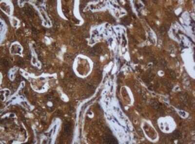 Immunohistochemistry: Complement Component C1s Antibody (OTI2A8) [NBP2-45566]