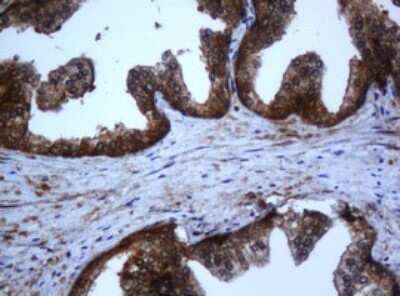 Immunohistochemistry: Complement Component C1s Antibody (OTI2A8) [NBP2-45566]