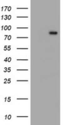 Western Blot: Complement Component C1s Antibody (OTI2A8) [NBP2-45566]