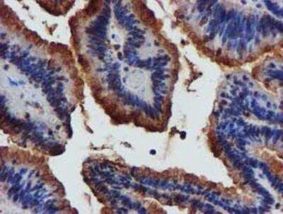 Immunohistochemistry-Paraffin: Complement Component C1s Antibody (OTI4E3) [NBP2-01625]