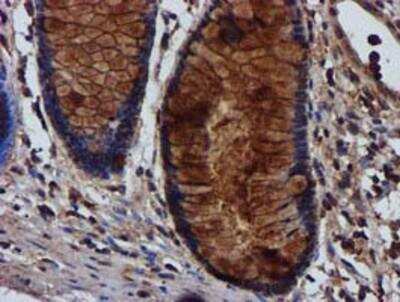 Immunohistochemistry-Paraffin: Complement Component C1s Antibody (OTI4E3) [NBP2-01625]