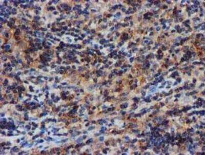 Immunohistochemistry-Paraffin: Complement Component C1s Antibody (OTI4E3) [NBP2-01625]