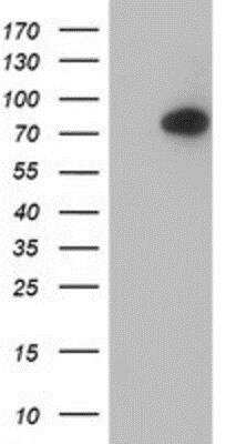 Western Blot: Complement Component C1s Antibody (OTI4E3) [NBP2-01625]