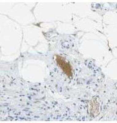 Immunohistochemistry: Complement Component C1s Antibody (9) - (Pro and Active) - BSA Free [NBP1-05023]