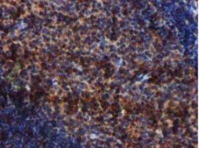 Immunohistochemistry-Paraffin: Complement Component C1s Antibody (OTI4E3) [NBP2-01625]