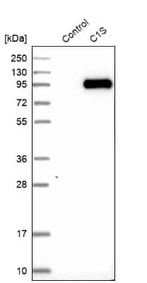 Western Blot: Complement Component C1s Antibody [NBP1-86439]