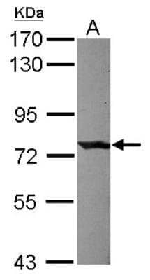 Western Blot: Complement Component C1s Antibody [NBP2-15643]