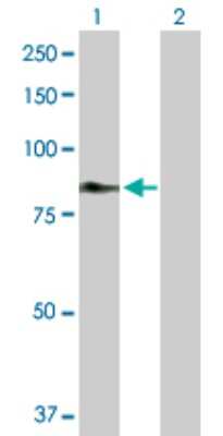 Western Blot: Complement Component C2 Antibody [H00000717-D01P]