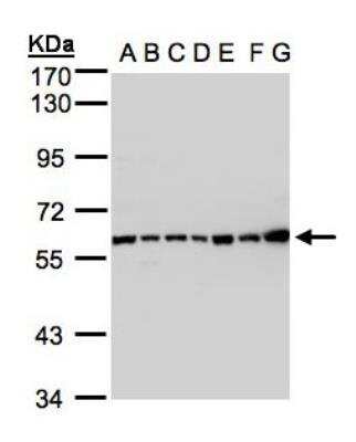 Western Blot: Complement Component C2 Antibody [NBP1-32589]