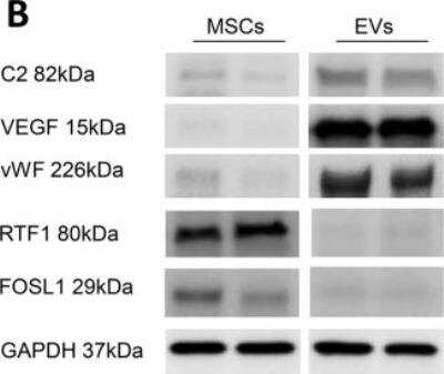 Western Blot: Complement Component C2 Antibody [NBP1-58985]