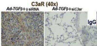 Immunohistochemistry-Paraffin: Complement Component C3aR Antibody [NBP2-15649]