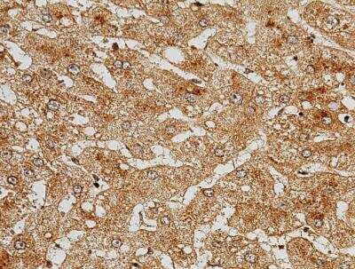 Immunohistochemistry-Paraffin: Complement Component C5a Antibody (215) [NBP2-89578]