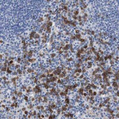 Immunohistochemistry-Paraffin: Complement Component C5aR1 Antibody [NBP1-88258]