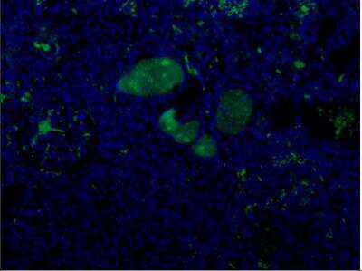 Immunohistochemistry: Complement Component C9 Antibody (22) - BSA Free [NBP2-21612]