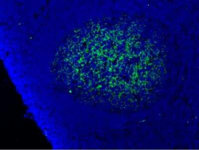 Immunohistochemistry: Complement Component C9 Antibody (22) - BSA Free [NBP2-21612]