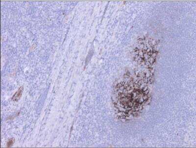 Immunohistochemistry: Complement Component C9 Antibody (22) - BSA Free [NBP2-21612]