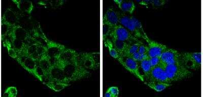 Immunocytochemistry/ Immunofluorescence: Complement Component C9 Antibody [NBP2-15952]