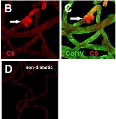 Immunohistochemistry: Complement Component C9 Antibody [NBP2-15952]