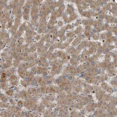 Immunohistochemistry-Paraffin: Complement Component C9 Antibody [NBP1-87440]