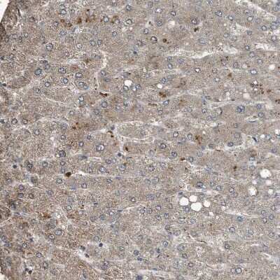 Immunohistochemistry-Paraffin: Complement Component C9 Antibody [NBP1-87440]