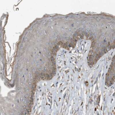 Immunohistochemistry-Paraffin: Complement Component C9 Antibody [NBP1-87440]