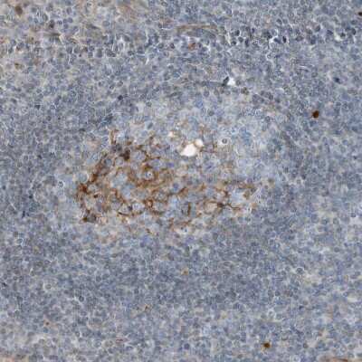 Immunohistochemistry-Paraffin: Complement Component C9 Antibody [NBP1-87440]