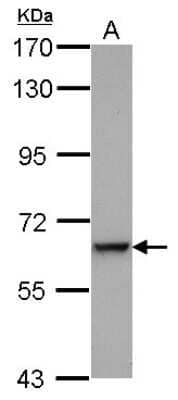 Western Blot: Complement Component C9 Antibody [NBP2-15952]