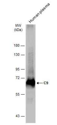 Western Blot: Complement Component C9 Antibody [NBP2-15952]